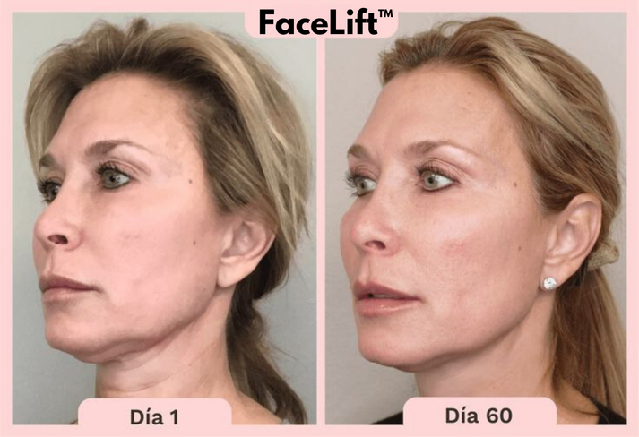 Masajeador Facial Con Microcorriente